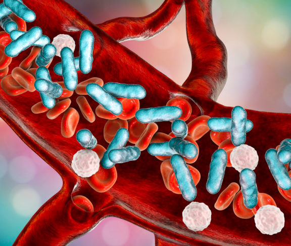 Sepsis, bacteria in blood. 3D illustration showing rod-shaped bacteria with red blood cells and leukocytes