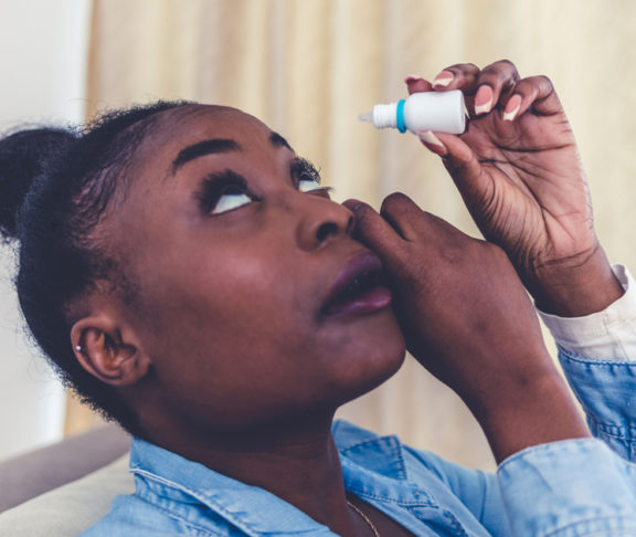 Woman using eye drop, woman dropping eye lubricant to treat dry eye or allergy, sick woman treating eyeball irritation or inflammation woman suffering from irritated eye, optical symptoms.