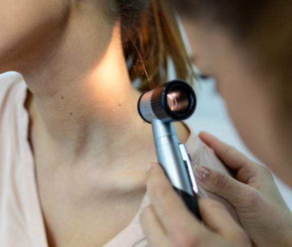 Doctor dermatologist examines skin of patient. Dermatoscopy, prevention of melanoma, skin cancer